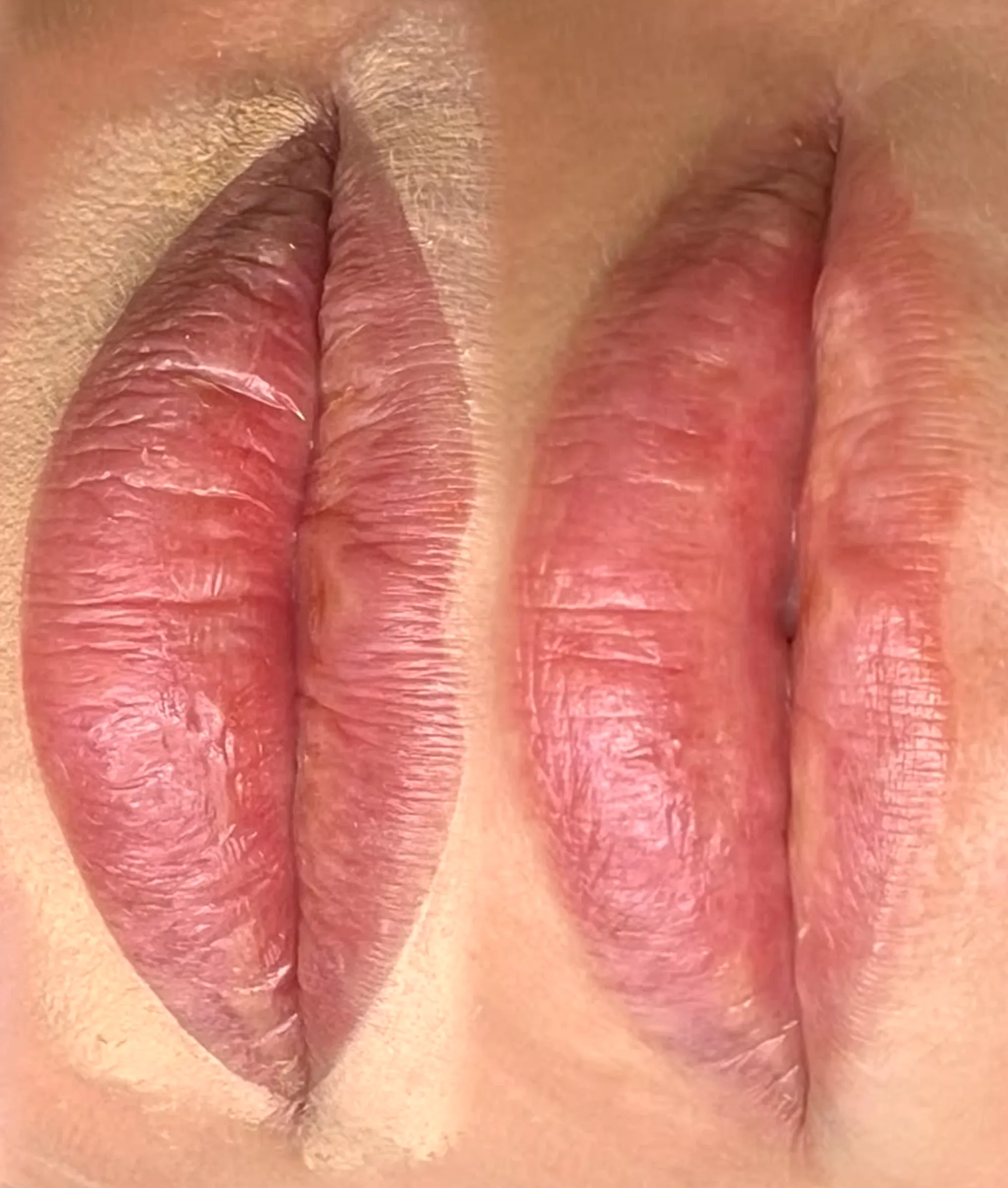 lip blush healing stages