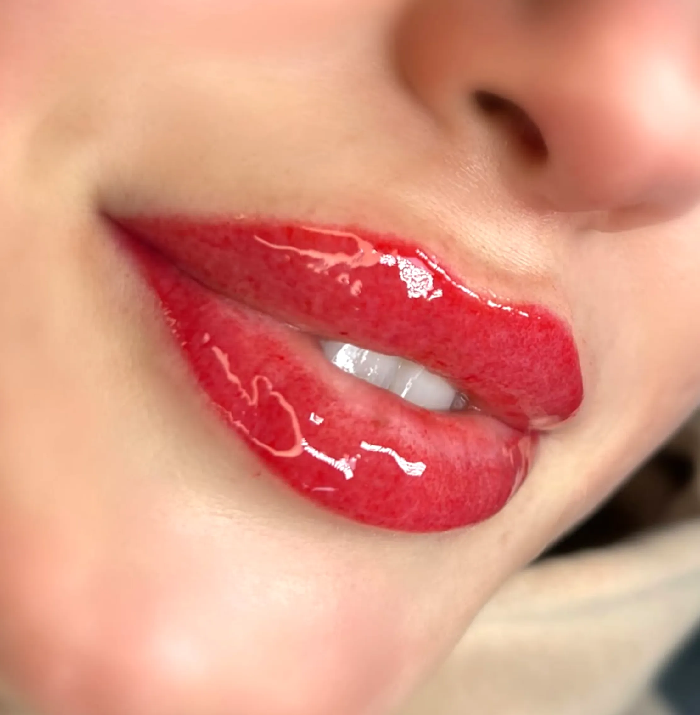 What are the stages of lip healing?