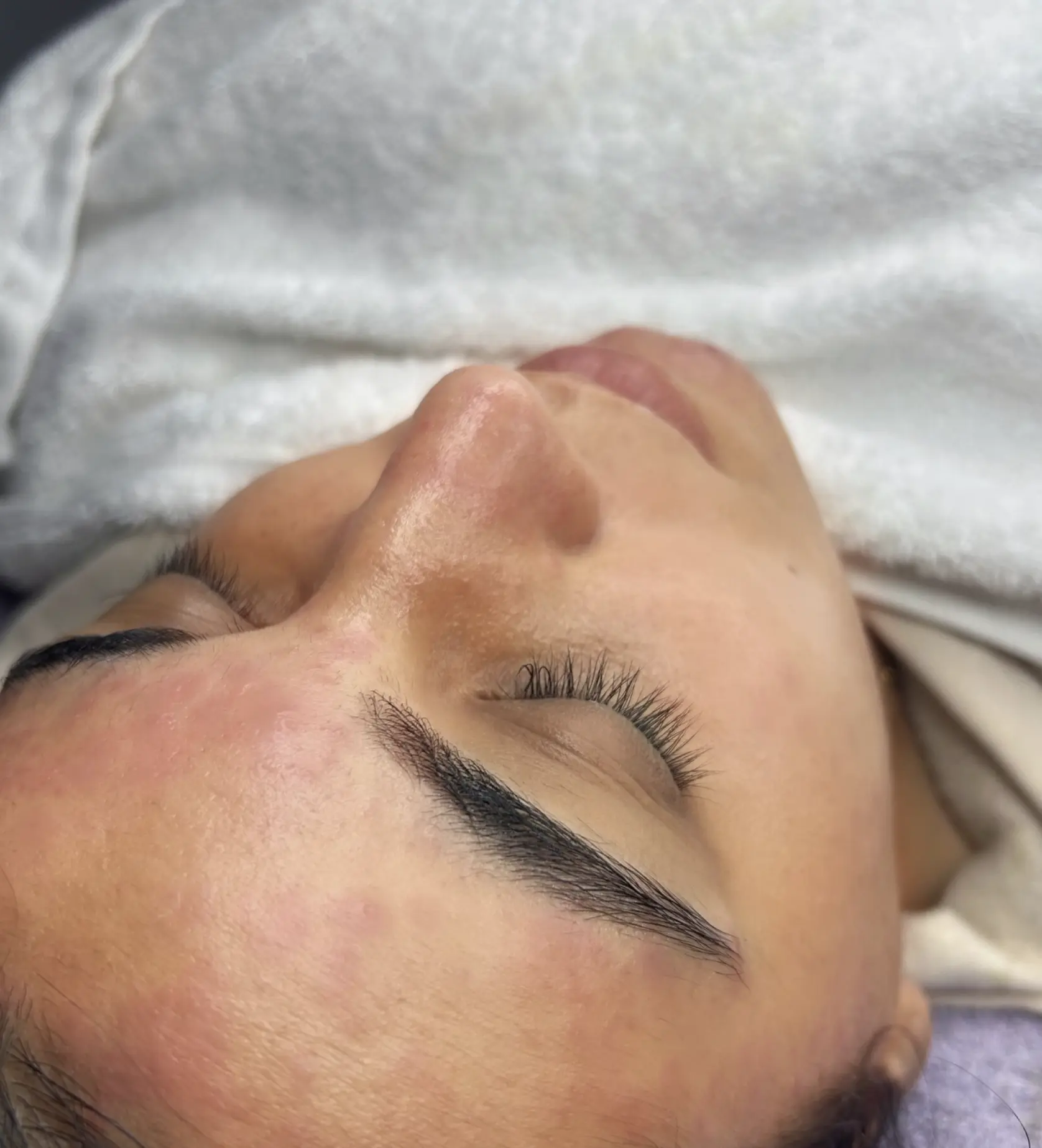 Is The “Medical-Grade” Hydrafacial Really Different From A Spa Version?